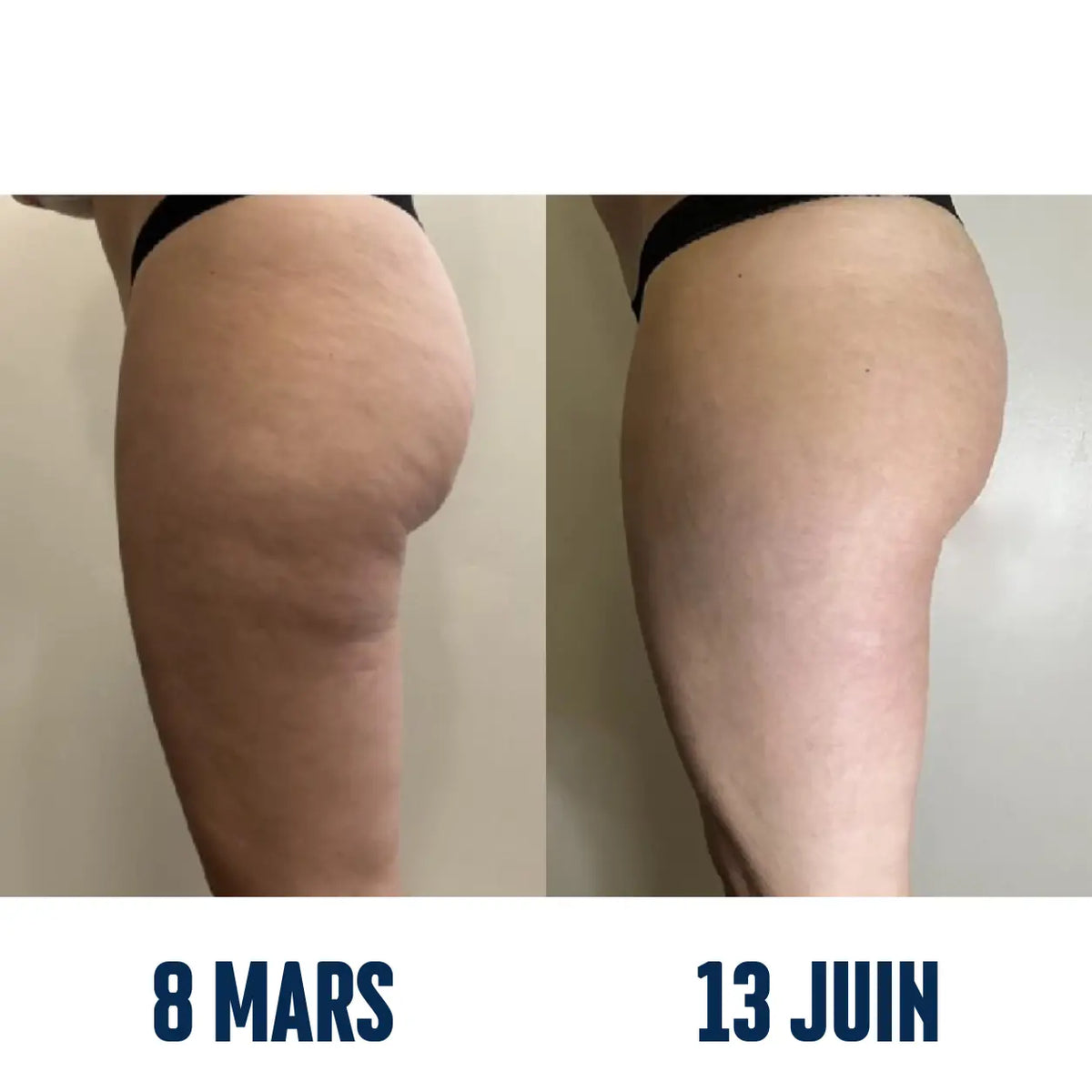 Legging UPP 3D Sculptant™ 🇫🇷